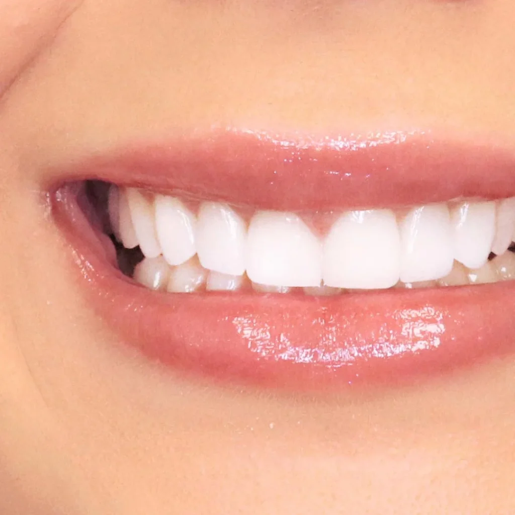 usluge-estetska-dentalna-medicina